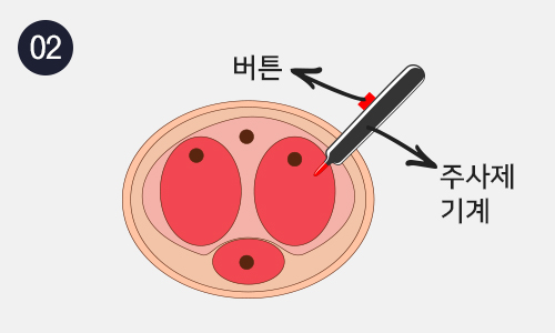 발기부전 주사제 이미지