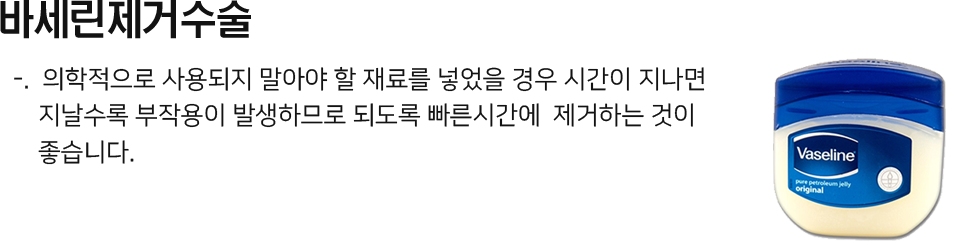 바세린제거수술 의학적으로 사용되지 말아야 할 재료를 넣었을 경우 시간이 지나면 지날수록 부작용이 발생하므로 되도록 빠른시간에 제거하는 것이 좋습니다.